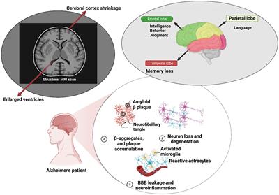 Alzheimer’s disease and microorganisms: the non-coding RNAs crosstalk